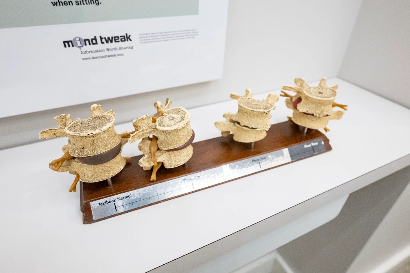 Four anatomical models of spinal vertebrae and discs on a wooden base, showing progression from 'Textbook Normal' to 'Phase Three' degeneration. A 'mind tweak' sign is in the background.